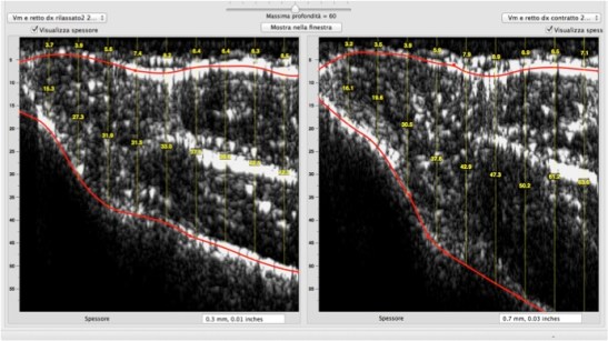 contratto e rilassato